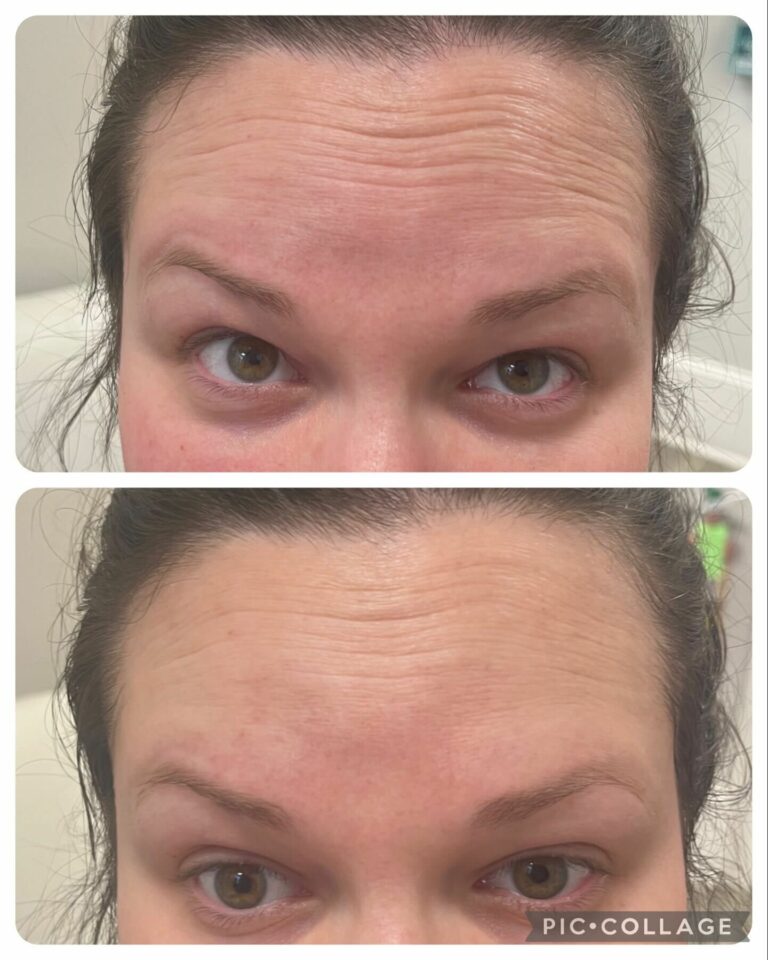 Revision Revox Line Relaxer Saintly Skin